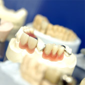Zahnersatz und Implantologie